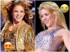 Пластика не спасет: Эксперты нашли причину резкого «старения» Шакиры