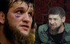 «Больной» Кадыров избил на глазах у ребенка лучшего бойца России 2015 года