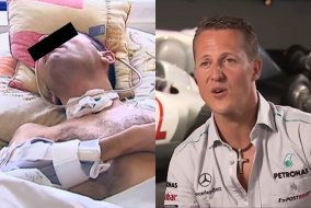 Без слез не взглянешь… Как может выглядеть Шумахер после жуткой травмы