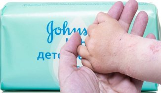 «Мамы, не рискуете!» Мыло JOHNSON\'S Baby вызвало контактный дерматит и сильную аллергию