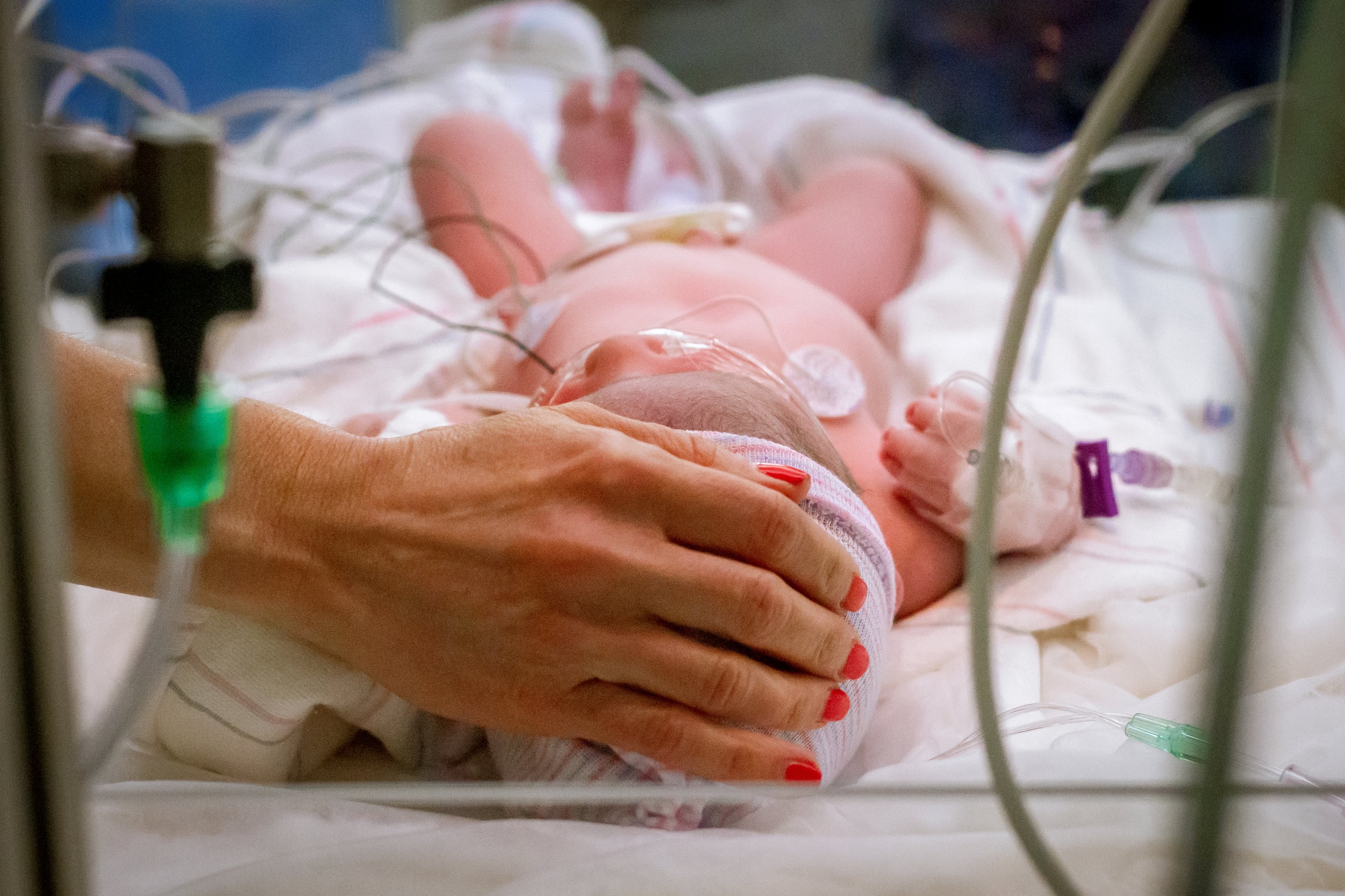 Почему новорожденных умирают. Новорожденный ребенок в больнице. Реанимация новорожденного.