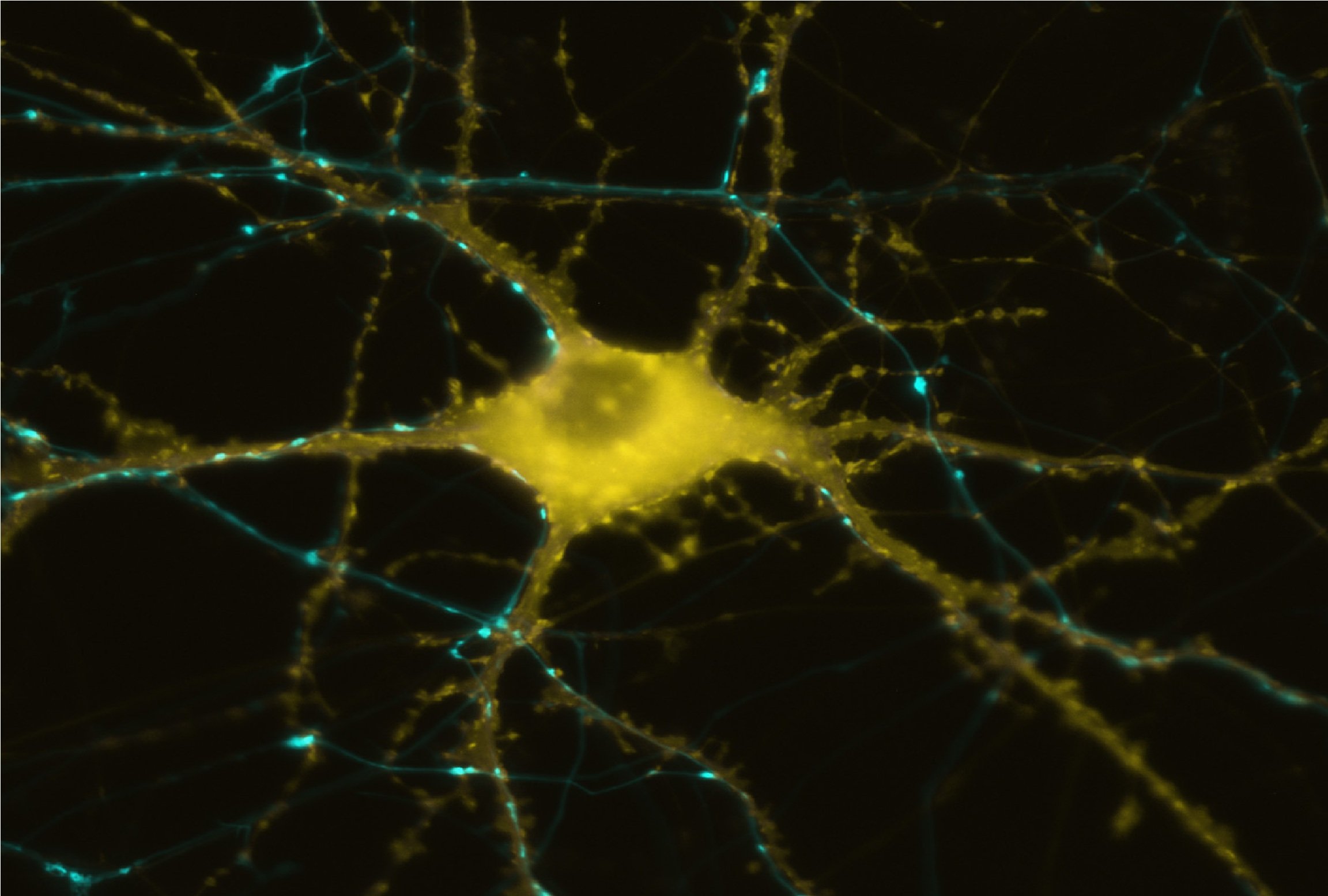 Новые клетки мозга. Клетки мозга. Клетки мозга под микроскопом. Нейроны мозга под микроскопом. Нейроны в микроскопе.