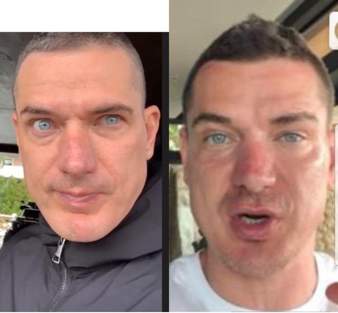 курбан омаров фото до и после операции