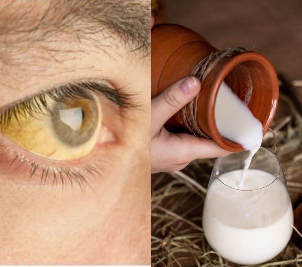 Неожиданные симптомы в глазах выявят анемию