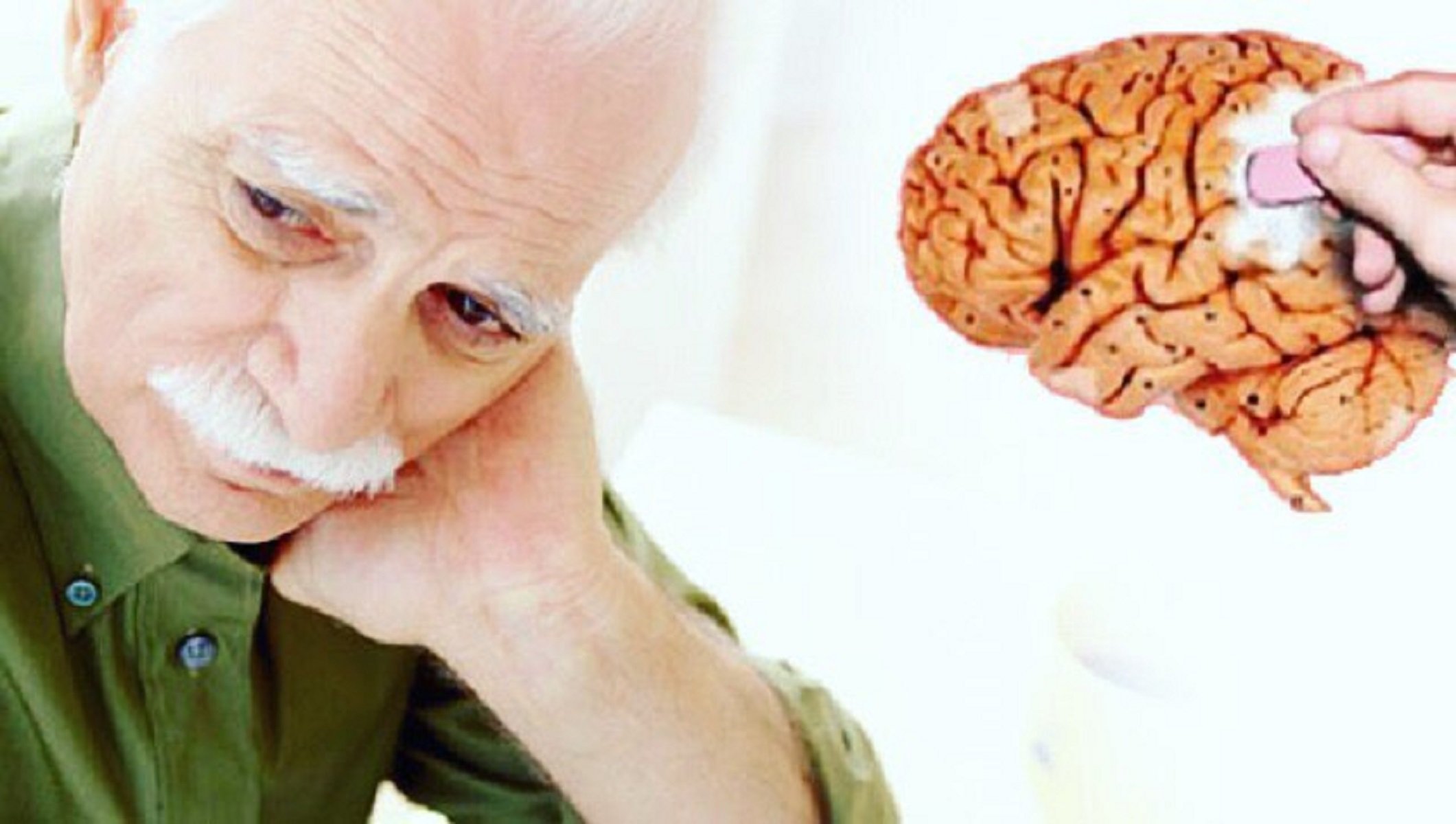 Слабоумие картинки. Хвороба Альцгеймера. Деменция Альцгеймера. Мозг пожилых людей.