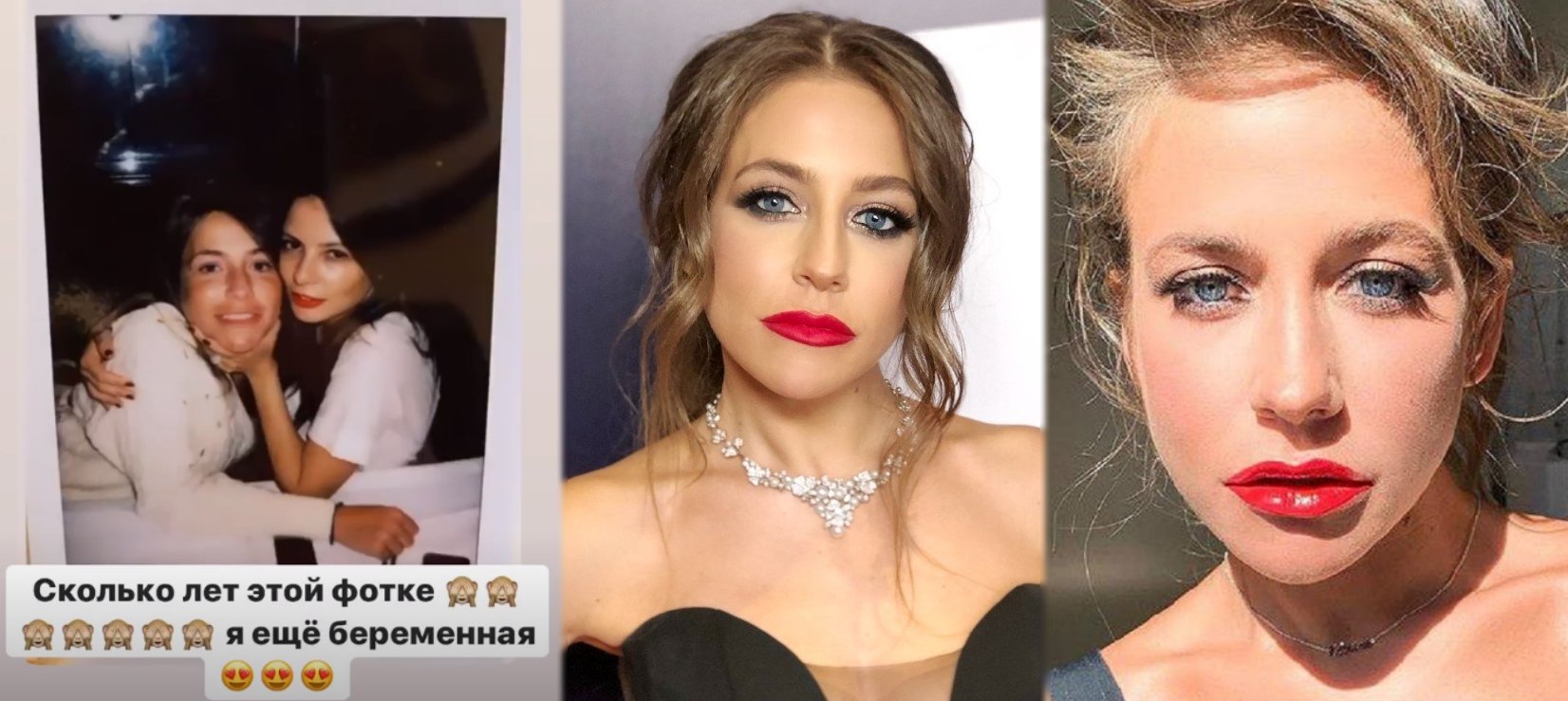 Барановская Юлия до и после пластики фото как выглядела