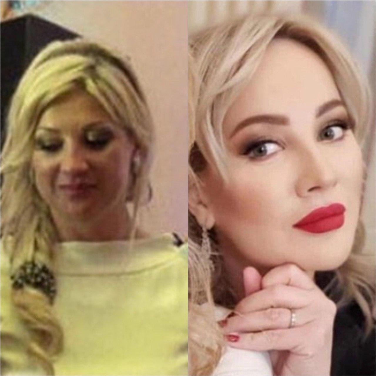 Жена михайлова до и после пластики фото