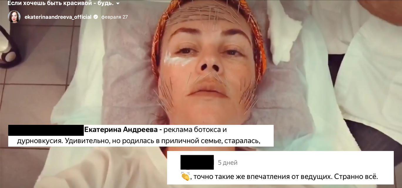 Екатерина Андреева без макияжа. фото до пластики и после