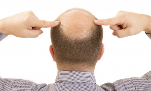 Учёные США вырастили человеческую кожу с волосами в чашке Петри