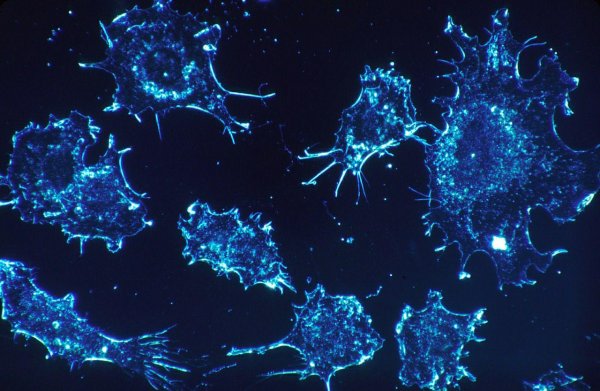 Исследователи нашли метод помощи иммунитету в борьбе с раком