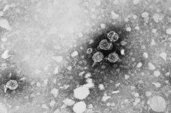 Несколько медикаментов против гепатита С показали эффективность в борьбе с коронавирусом